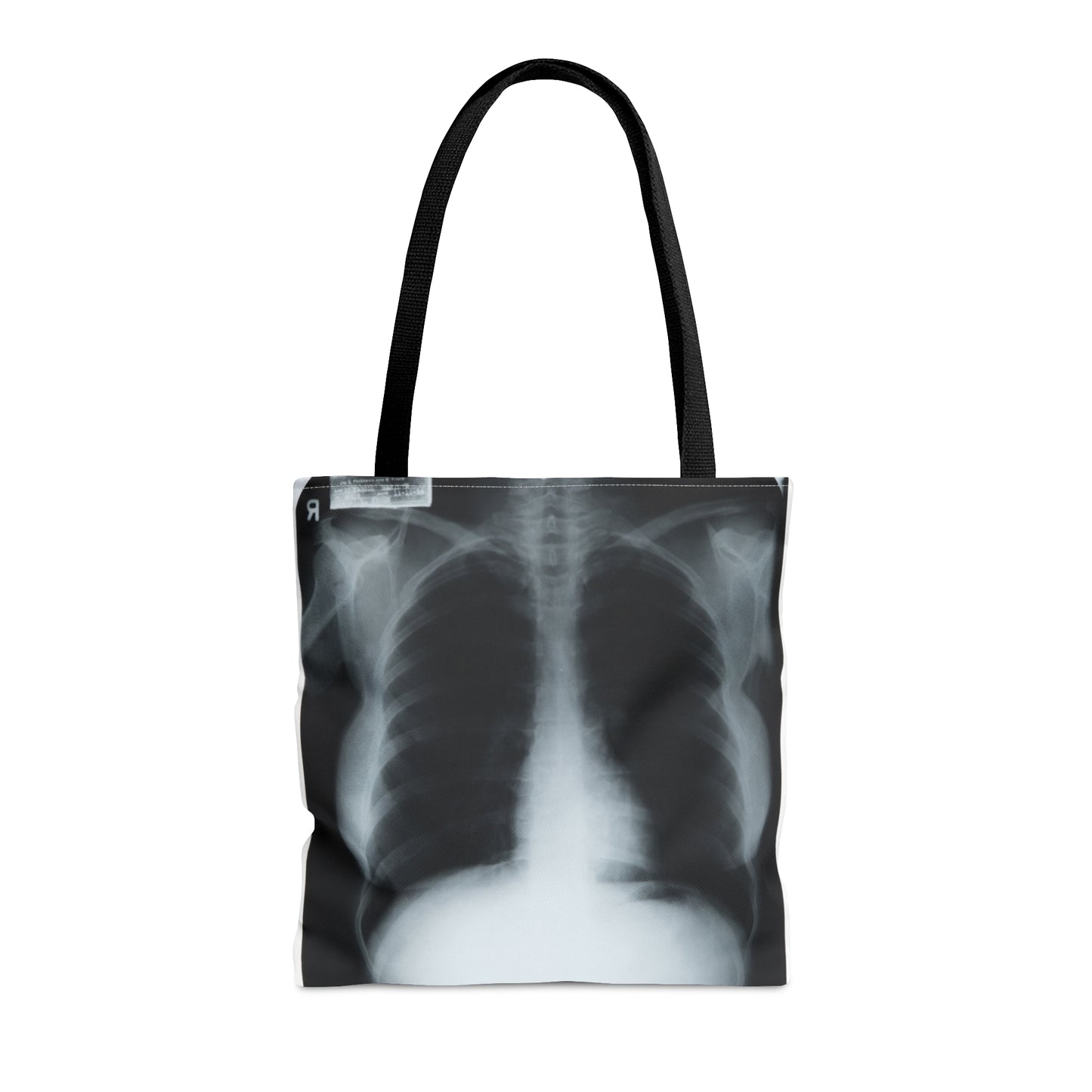 Chest X-Ray Tote