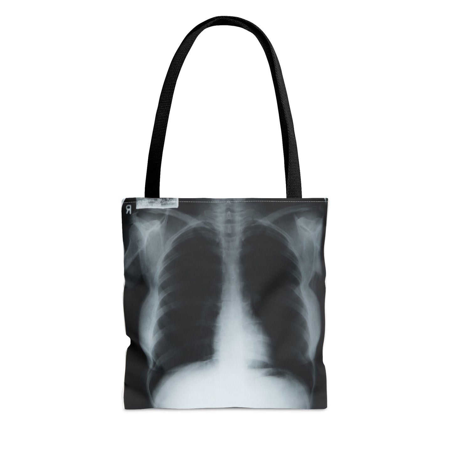 Chest X-Ray Tote