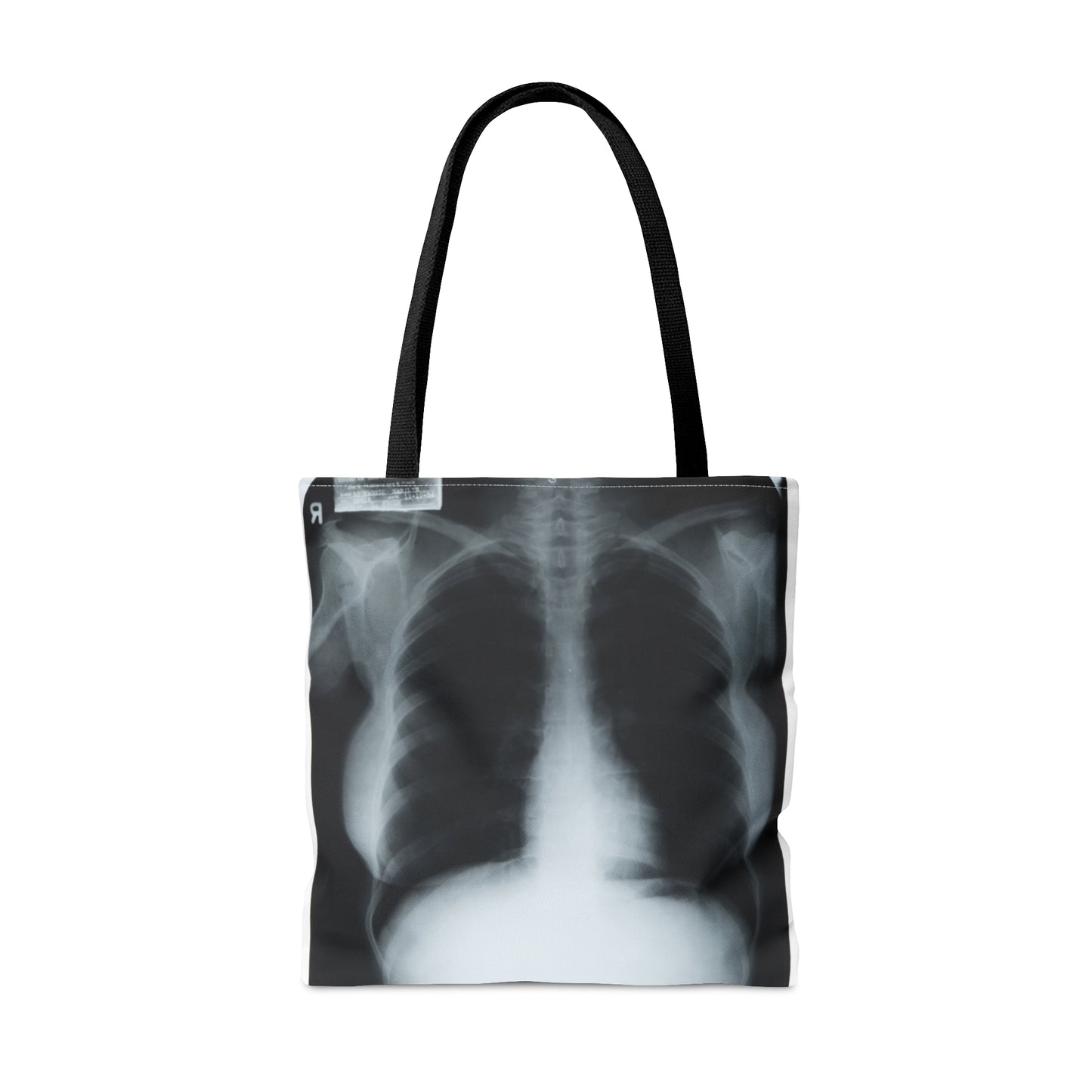 Chest X-Ray Tote