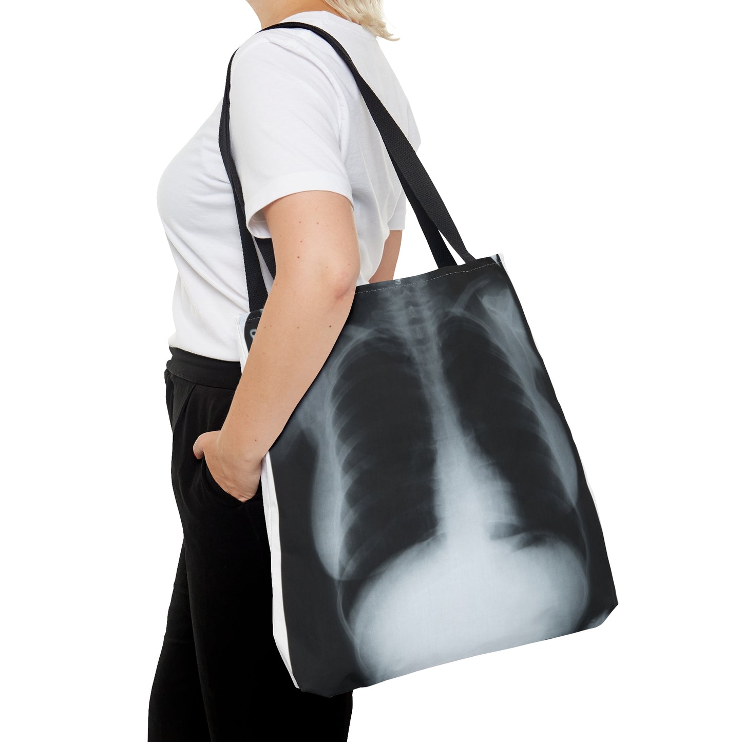 Chest X-Ray Tote