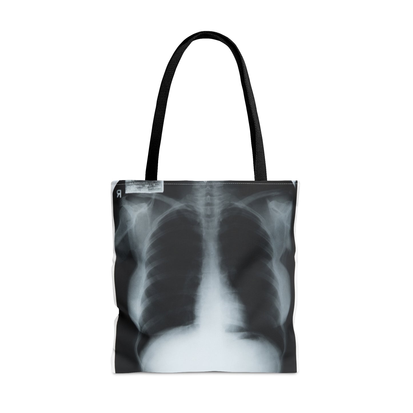 Chest X-Ray Tote
