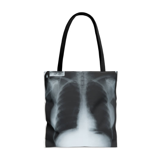 Chest X-Ray Tote