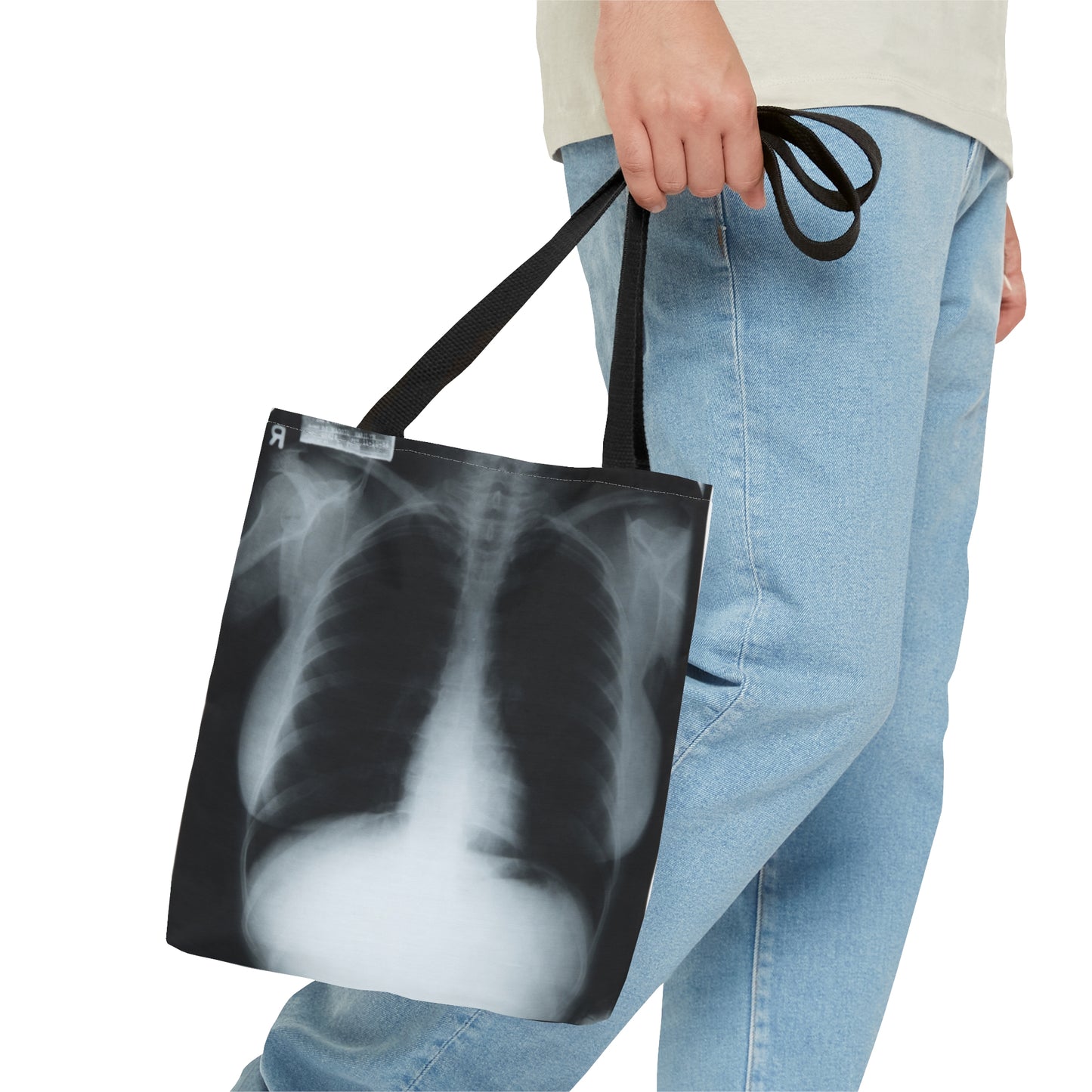 Chest X-Ray Tote